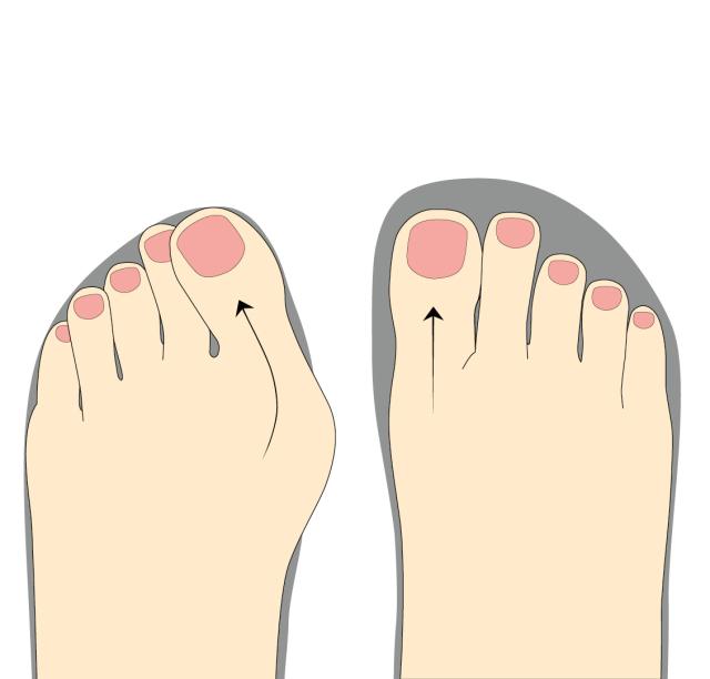 If there is not enough room for your toes